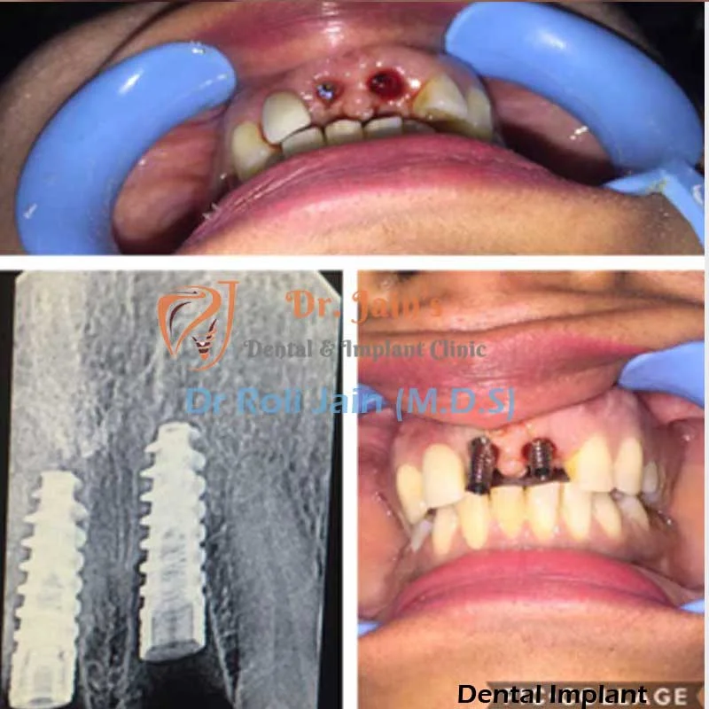 Dr Jain Dental & Implant Clinic